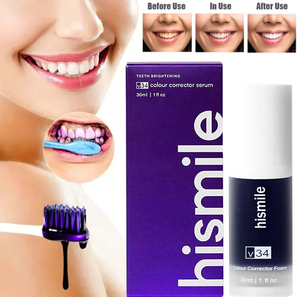 Teeth Whitening HiSmile V34 | ORIGINAL